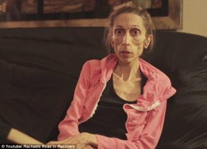 28EC042D00000578-3090351-Plea_Rachael_Farrokh_from_California_who_has_been_battling_anore-a-5_1432209432432